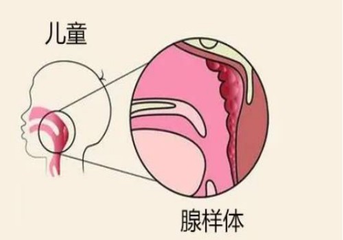 百分之九十的人不知道这些症状是卵子质量差的表现